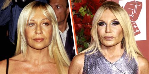 donatella versace przed operacjami|Donatella Versace's Plastic Surgery Transformations .